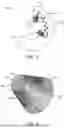 Fig. 03 - HEATER FOR AN AEROSOL DELIVERY DEVICE AND METHODS OF FORMATION THEREOF