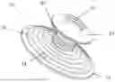 Fig. 01 - Novel Attachment for Locking Prosthetic Liners