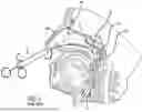 Fig. 06 - EUSTACHIAN TUBE DILATION BALLOON WITH VENTILATION PATH