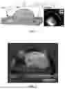Fig. 02 - LIQUID CRYSTAL-INFUSED POROUS SURFACES AND METHODS OF MAKING AND USE THEREOF