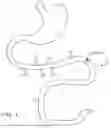 Fig. 02 - SWALLOWABLE CAPSULE AND METHOD FOR STIMULATING INCRETIN PRODUCTION WITHIN THE INTESTINAL TRACT