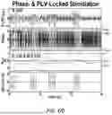 Fig. 09 - METHODS AND APPARATUS FOR RESTORATION OF BRAIN NETWORK ACTIVITY