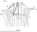 Fig. 03 - SYSTEMS AND METHODS FOR STIMULATION OF CRANIAL NERVES