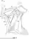 Fig. 04 - SYSTEMS AND METHODS FOR STIMULATION OF CRANIAL NERVES