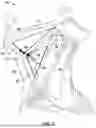 Fig. 10 - SYSTEMS AND METHODS FOR STIMULATION OF CRANIAL NERVES