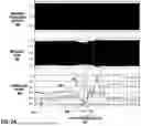 Fig. 07 - FEEDBACK CONTROL OF ELECTRICAL STIMULATION THERAPY BASED ON ELECTRIC FIELD IMAGING