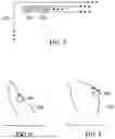 Fig. 04 - METHOD AND APPARATUS TO MODIFY DOSE VALUES DURING RADIATION TREATMENT PLANNING