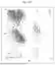 Fig. 41 - KERATINASE COMPOSITION