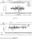 Fig. 79 - FUNCTIONAL GENOMICS USING CRISPR-CAS SYSTEMS FOR SATURATING MUTAGENESIS OF NON-CODING ELEMENTS, COMPOSITIONS, METHODS, LIBRARIES AND APPLICATIONS THEREOF