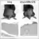 Fig. 01 - APPLICATION OF VEGFR GENE EXPRESSION INHIBITOR IN PREPARING PREPARATION OR AS PREPARATION FOR TREATING PSORIASIS