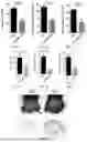 Fig. 05 - APPLICATION OF VEGFR GENE EXPRESSION INHIBITOR IN PREPARING PREPARATION OR AS PREPARATION FOR TREATING PSORIASIS