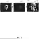 Fig. 08 - METHOD AND DEVICE FOR PROVIDING SURGICAL GUIDE USING AUGMENTED REALITY