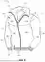 Fig. 06 - Insulated Composite Fabric