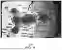 Fig. 09 - METHODS AND SYSTEMS FOR DETECTING PHYSIOLOGIC SIGNALS FROM A CAMERA