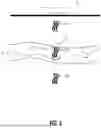Fig. 04 - Detecting fluid flows using ultrasound imaging systems