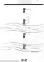 Fig. 06 - Detecting fluid flows using ultrasound imaging systems