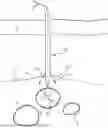 Fig. 01 - TISSUE CLOSURE DEVICE