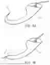 Fig. 04 - TISSUE CLOSURE DEVICE