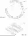 Fig. 09 - TISSUE CLOSURE DEVICE