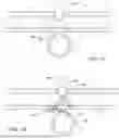 Fig. 15 - TISSUE CLOSURE DEVICE