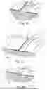 Fig. 03 - Non-Invasive Wound Closure Device