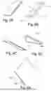 Fig. 05 - Non-Invasive Wound Closure Device