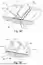 Fig. 08 - Non-Invasive Wound Closure Device