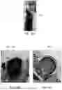 Fig. 17 - SYSTEMS, APPARATUS AND METHODS FOR PROCESSING AUTOLOGOUS BLOOD FOR REINFUSION INTO A PATIENT