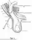 Fig. 02 - METHOD AND PROSTHESIS FOR PERCUTANEOUS HERNIA REPAIR