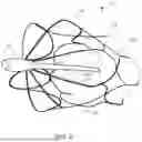 Fig. 04 - Retrievable Self-Expanding Non-Thrombogenic Low-Profile Percutaneous Atrioventricular Valve Prosthesis