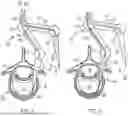 Fig. 03 - IN-SITU ADDITIVE CHANNELED IMPLANTS