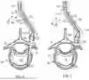 Fig. 05 - IN-SITU ADDITIVE CHANNELED IMPLANTS