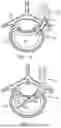 Fig. 08 - IN-SITU ADDITIVE CHANNELED IMPLANTS