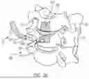 Fig. 19 - IN-SITU ADDITIVE CHANNELED IMPLANTS