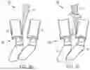 Fig. 20 - IN-SITU ADDITIVE CHANNELED IMPLANTS