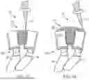 Fig. 22 - IN-SITU ADDITIVE CHANNELED IMPLANTS