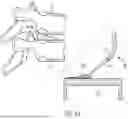 Fig. 30 - IN-SITU ADDITIVE CHANNELED IMPLANTS