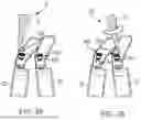 Fig. 35 - IN-SITU ADDITIVE CHANNELED IMPLANTS