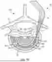 Fig. 40 - IN-SITU ADDITIVE CHANNELED IMPLANTS