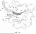 Fig. 44 - IN-SITU ADDITIVE CHANNELED IMPLANTS