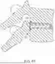 Fig. 46 - IN-SITU ADDITIVE CHANNELED IMPLANTS