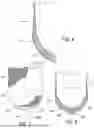 Fig. 07 - VENTILATED PROSTHETIC LINER