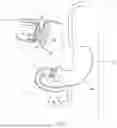 Fig. 02 - SYSTEMS AND METHODS FOR ANCHORING AND RESTRAINING GASTROINTESTINAL PROSTHESES