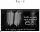 Fig. 16 - SYSTEM FOR ARTIFICIAL VISION