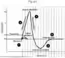 Fig. 97 - SYSTEM FOR ARTIFICIAL VISION