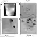 Fig. 03 - NANOLIPID CARRIER BASED FORMULATION FOR BRAIN DELIVERY THROUGH INTRANASAL ROUTE AND ITS PREPARATION PROCESS