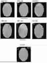 Fig. 07 - NANOLIPID CARRIER BASED FORMULATION FOR BRAIN DELIVERY THROUGH INTRANASAL ROUTE AND ITS PREPARATION PROCESS