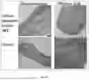 Fig. 14 - NANOLIPID CARRIER BASED FORMULATION FOR BRAIN DELIVERY THROUGH INTRANASAL ROUTE AND ITS PREPARATION PROCESS