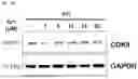 Fig. 07 - PHARMACEUTICAL COMPOSITION FOR ENHANCING ANTICANCER EFFECT OF PROTAC, INCLUDING IU1-SERIES UBIQUITIN-SPECIFIC PROTEASE 14 INHIBITOR AS ACTIVE INGREDIENT