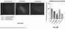 Fig. 10 - RNA-TARGETING COMPOSITIONS AND METHODS FOR TREATING MYOTONIC DYSTROPHY TYPE 1